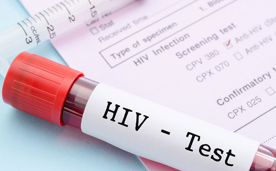Nuovi studi hiv in congo