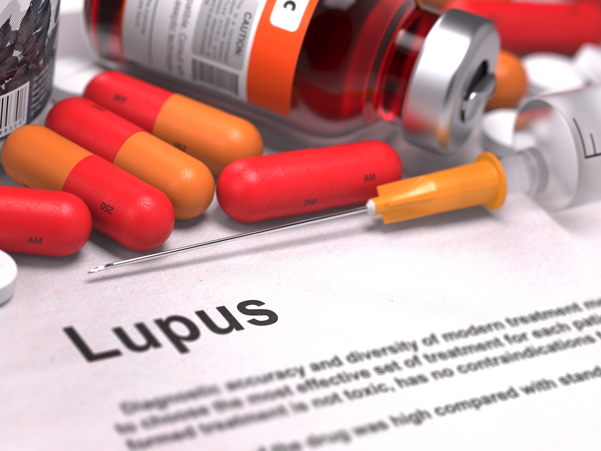 lupus cura e trattamento