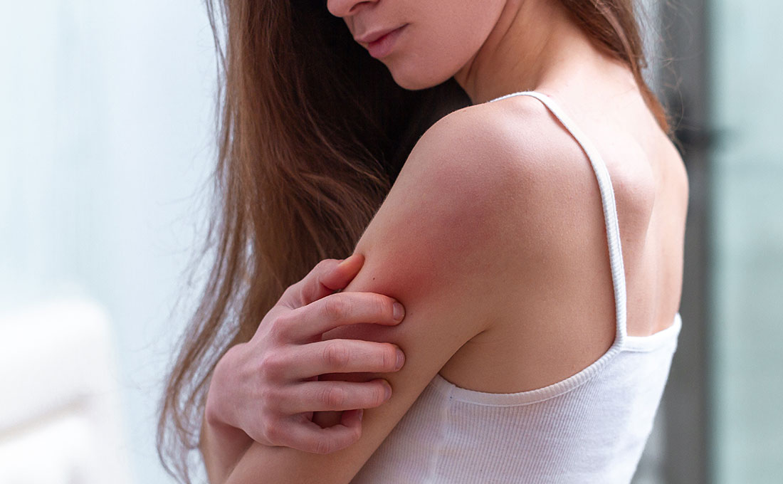 Come affronta la dermatite seboroica una giovane ragazza