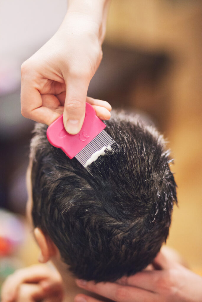Pettine Per Pidocchi E Lendini - In Acciaio Inossidabile, Doppia Faccia, Per Bambini E Adulti - Foto 11