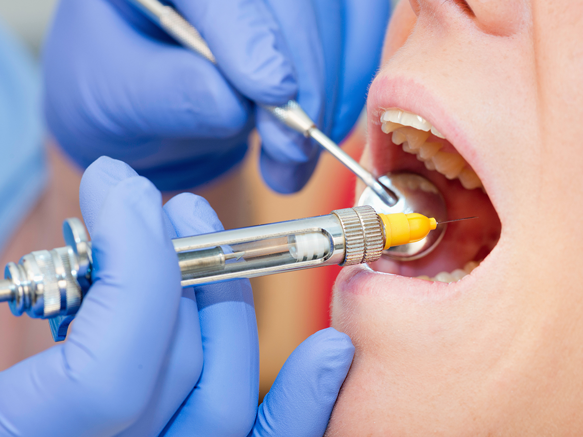 anestesia dentista effetti collaterali