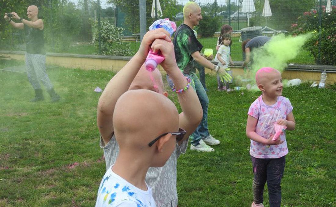 Bambini alopecia areata giocano