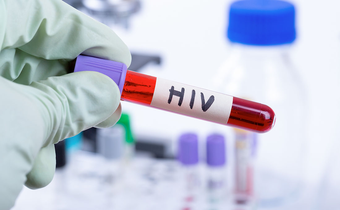 combattere virus hiv
